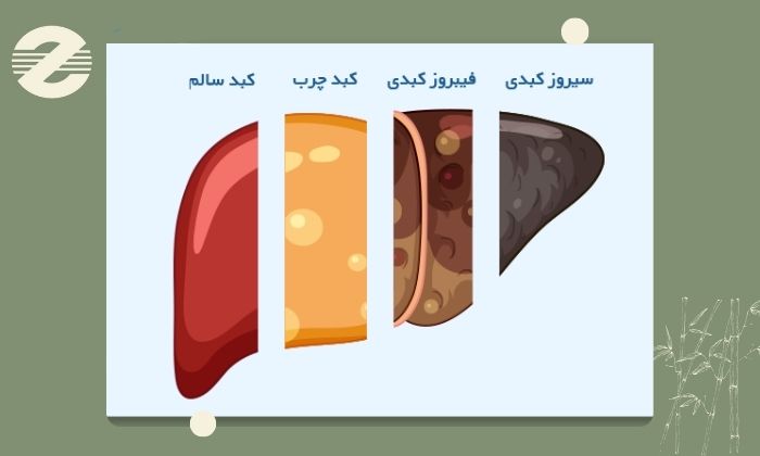 چرا فیبرواسکن کبد اهمیت دارد؟ چرا فیبرواسکن کبد اهمیت دارد؟