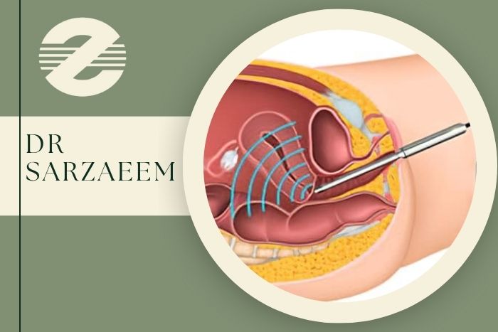سونوهیستروگرافی چگونه انجام می شود و در کرج کجا انجام می شود؟