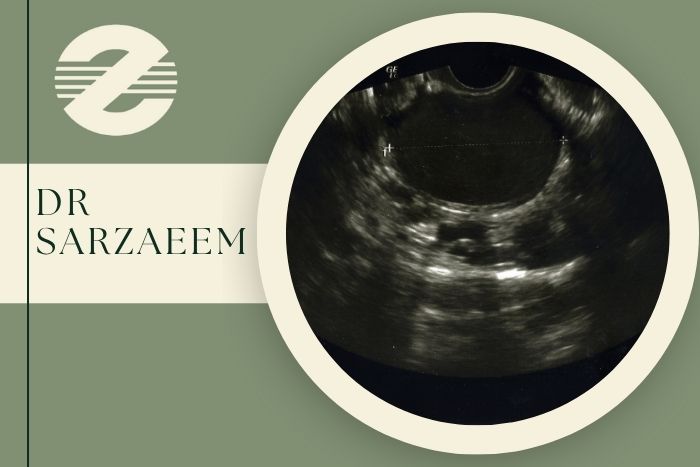 بهترین دکتر سونوگرافی اندومتریوز در کرج به صورت تخصصی بهترین دکتر سونوگرافی اندومتریوز در کرج به صورت تخصصی