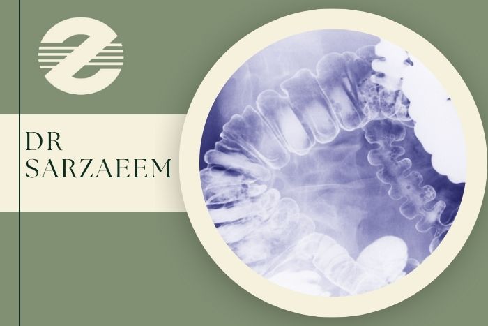 باریم انما | عکس رنگی روده چیست و در کرج کجا انجام می شود؟