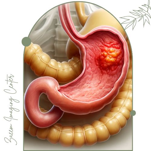 کاربردهای عکس رنگی از معده