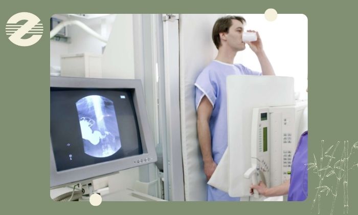 مراحل انجام بررسی معده با باریم