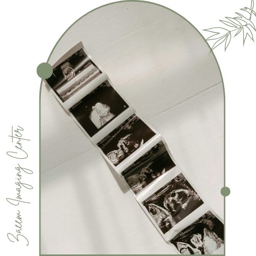 مهمترین موارد استفاده سونوگرافی مهمترین موارد استفاده سونوگرافی