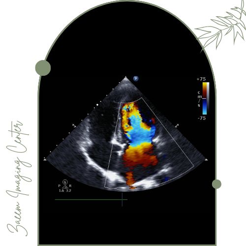 سونوگرافی کالر داپلر سونوگرافی کالر داپلر