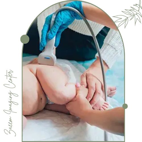 سونوگرافی هیپ نوزاد سونوگرافی هیپ نوزاد