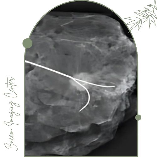 روش‌های تصویربرداری در نشان‌گذاری پستان