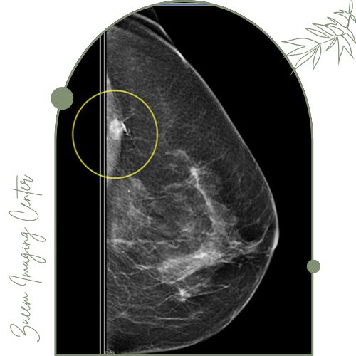 کاربرد علامت‌گذاری پستان