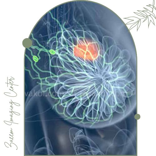 تفاوت وایرگذاری با روش‌های بیوپسی پستان