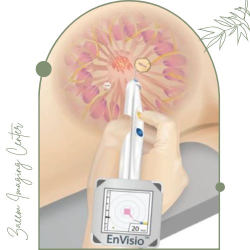 اهمیت نشانه‌ گذاری پستان