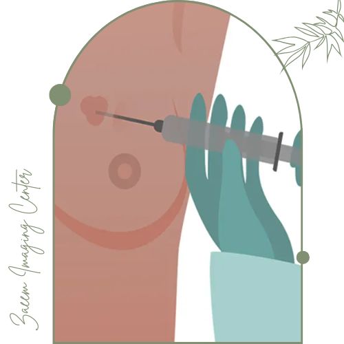 عوارض احتمالی مارکرگذاری سینه