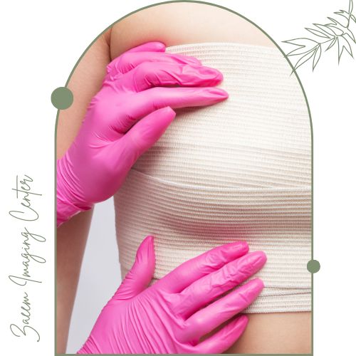 مراقبت‌های بعد از  نشانه‌گذاری سینه