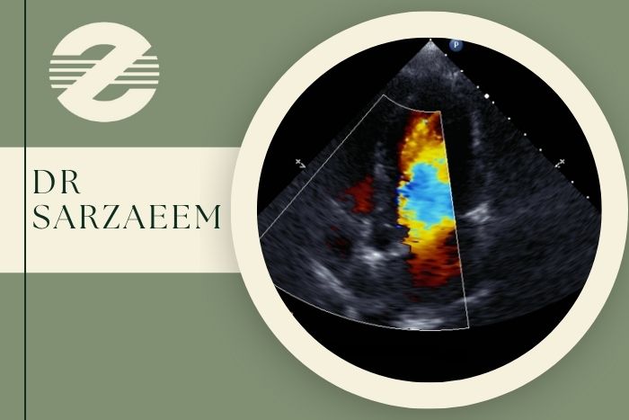 بهترین مرکز سونوگرافی کالر داپلر در کرج طرف قرارداد با بیمه ها بهترین مرکز سونوگرافی کالر داپلر در کرج طرف قرارداد با بیمه ها