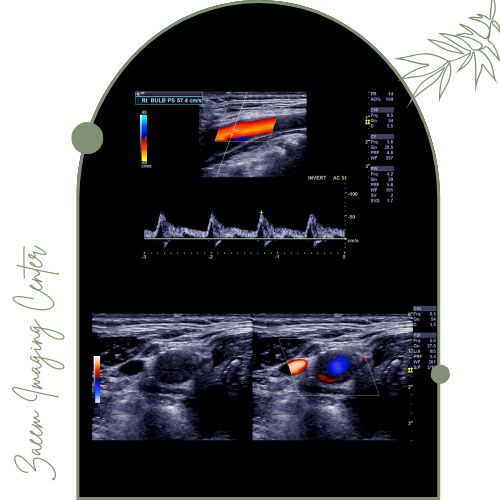 سونوگرافی داپلر رنگی چیست؟ سونوگرافی داپلر رنگی چیست؟