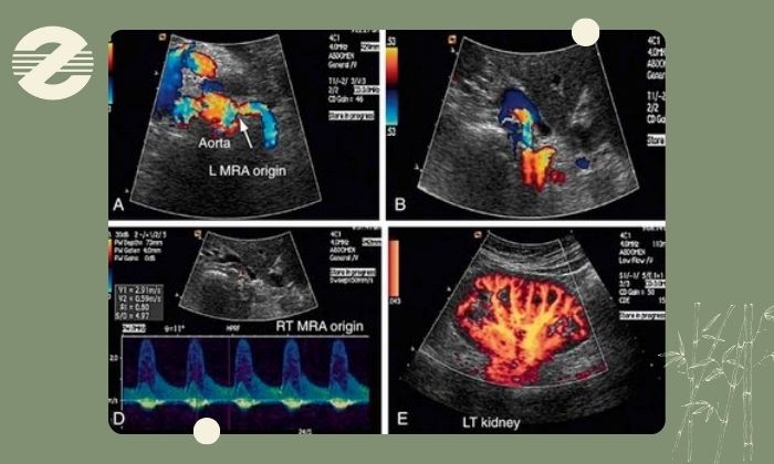 کاربردهای سونوگرافی رنگی داپلر کاربردهای سونوگرافی رنگی داپلر