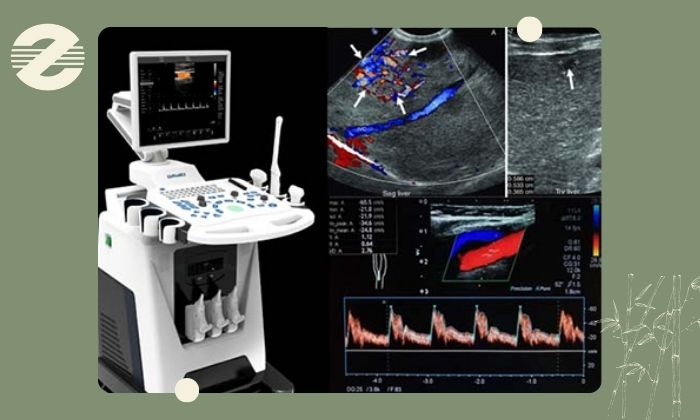 مزایای سونوگرافی داپلر رنگی مزایای سونوگرافی داپلر رنگی