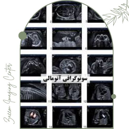 کاربردهای سونوگرافی آنومالی کاربردهای سونوگرافی آنومالی