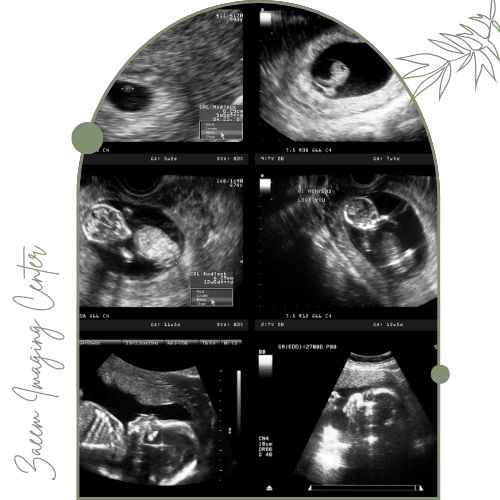 سونوگرافی آنومالی چیست؟ سونوگرافی آنومالی چیست؟