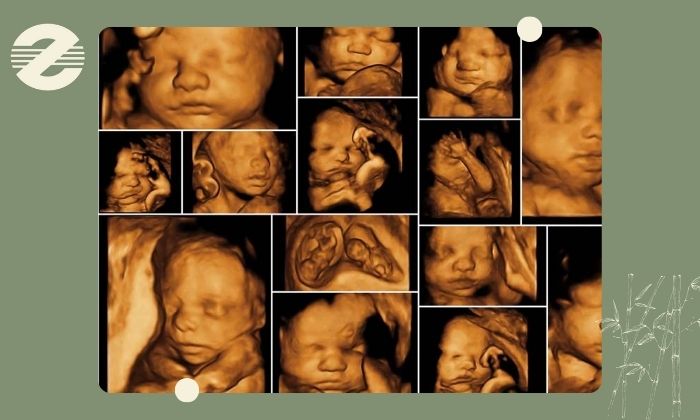 سونوگرافی آنومالی دوبعدی و سهبعدی جنین سونوگرافی آنومالی دوبعدی و سهبعدی جنین