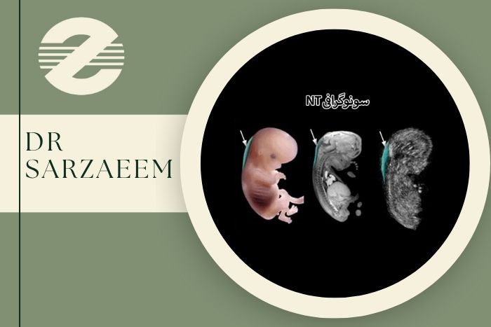 بهترین مرکز سونوگرافی NT در کرج با به روزترین دستگاه بهترین مرکز سونوگرافی NT در کرج با به روزترین دستگاه