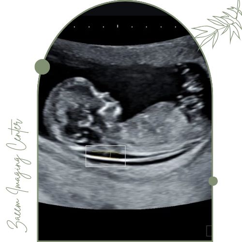 هدف اصلی سونوگرافی غربالگری انتی هدف اصلی سونوگرافی غربالگری انتی