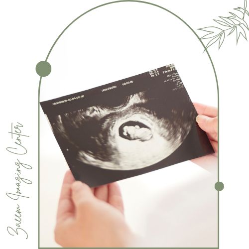 چه کسانی باید سونو nt انجام دهند؟ چه کسانی باید سونو nt انجام دهند؟