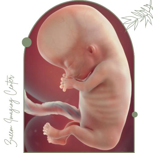 زمان مناسب انجام سونوگرافی تشخیصی NT زمان مناسب انجام سونوگرافی تشخیصی NT