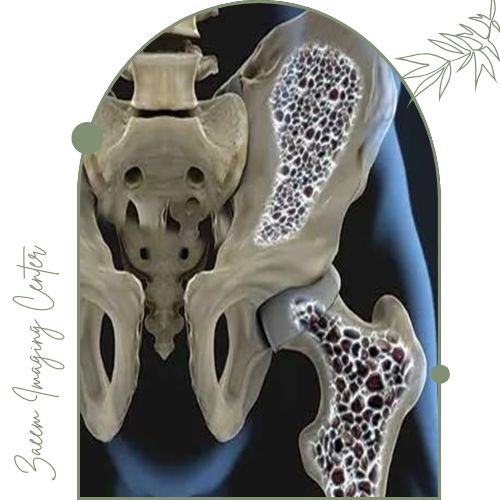 کاربردهای دنسیتومتری استخوان کاربردهای دنسیتومتری استخوان