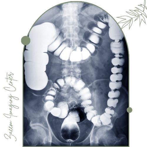 باریم انما چیست؟