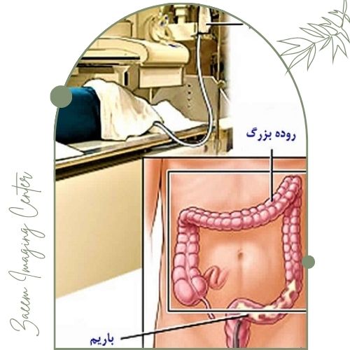 معایب و محدودیت‌های باریم انما