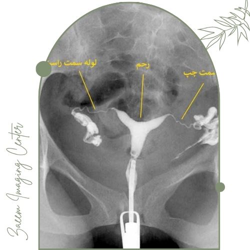 عکس رنگی رحم عکس رنگی رحم