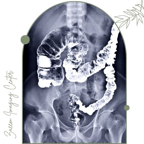 عکس رنگی روده (باریم انما) عکس رنگی روده (باریم انما)