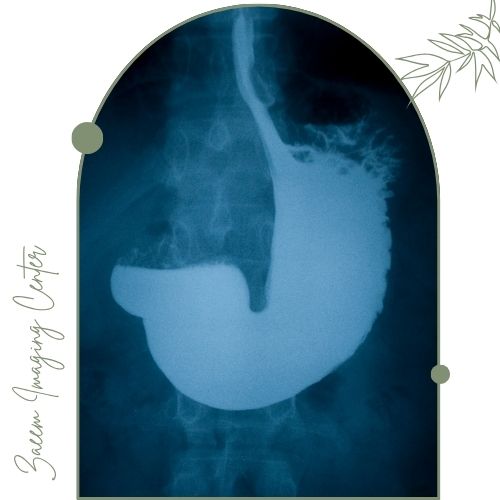 عکس رنگی معده (باریم میل) عکس رنگی معده (باریم میل)