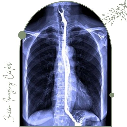 عکس رنگی مری و معده (باریم سوالو) عکس رنگی مری و معده (باریم سوالو)