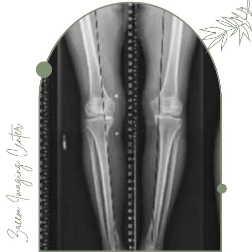 رادیوگرافی الایمنت ویو رادیوگرافی الایمنت ویو