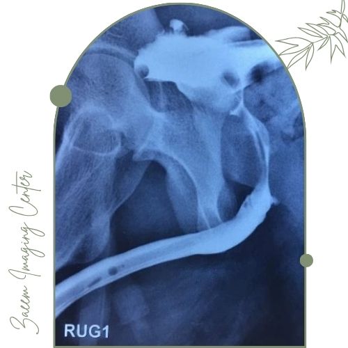 رتروگرید رتروگرید