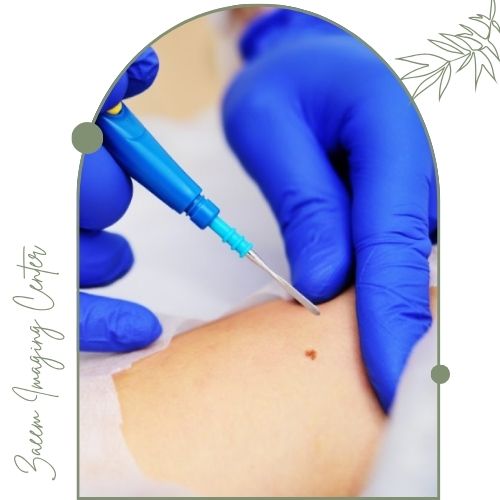 نمونه برداری چیست و چرا انجام میشود؟ نمونه برداری چیست و چرا انجام میشود؟