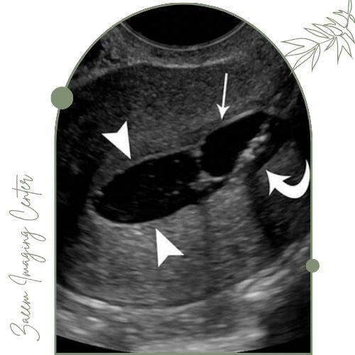 تفسیر نتایج هیستروسونوگرافی