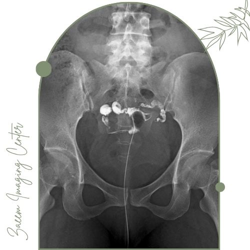 تفسیر نتایج عکس رنگی لوله‌های رحمی