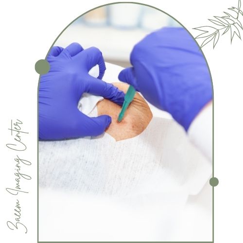 اهمیت نمونه برداری پستان اهمیت نمونه برداری پستان