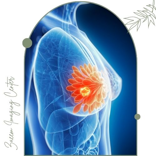 کاربرد نمونه برداری پستان کاربرد نمونه برداری پستان