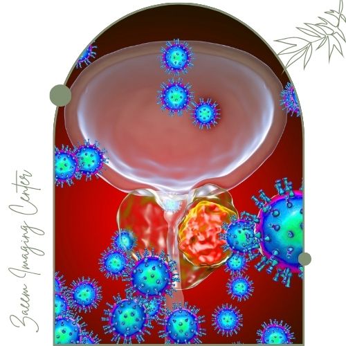 دلایل بیوپسی پروستات دلایل بیوپسی پروستات