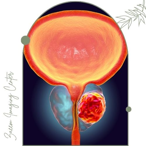 عوارض احتمالی بیوپسی پروستات عوارض احتمالی بیوپسی پروستات