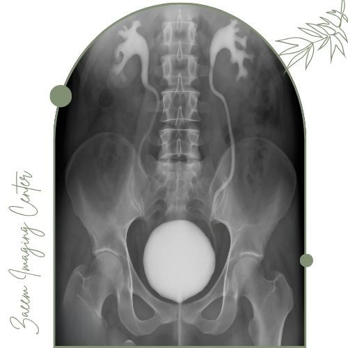 عکس رنگی مثانه (VCUG) چیست؟ عکس رنگی مثانه (VCUG) چیست؟