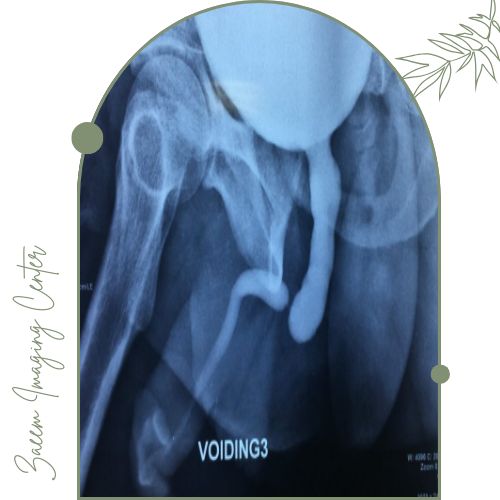 آمادگی قبل از انجام عکسبرداری آمادگی قبل از انجام عکسبرداری