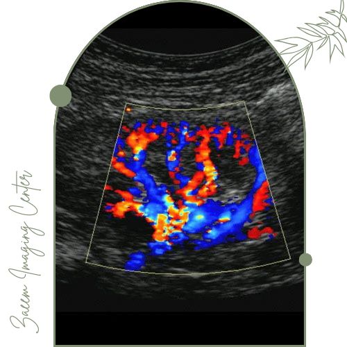 کاربردهای سونوگرافی داپلر از عروق