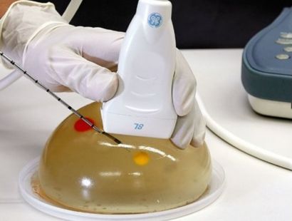 وایرگذاری تحت گاید سونوگرافی