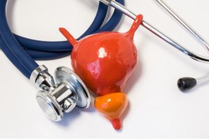 نمونه برداری پروستات نمونه برداری پروستات