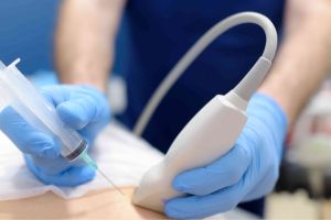 نمونه برداری سینه نمونه برداری سینه