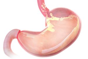 عکس رنگی معده (باریم میل) عکس رنگی معده (باریم میل)