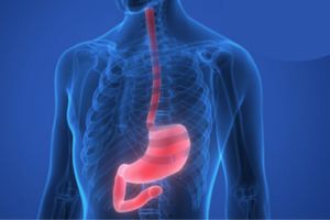 عکس رنگی مری و معده (باریم سوالو) عکس رنگی مری و معده (باریم سوالو)